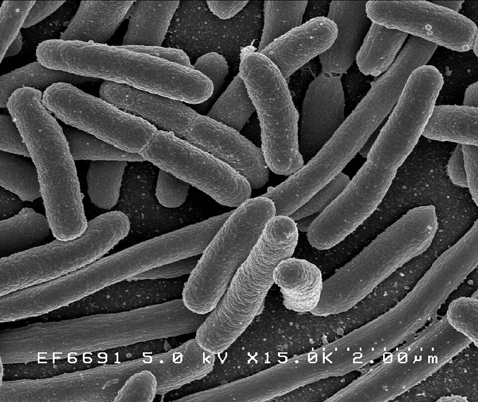 Células bacterianas de E. coli en un ensayo microbiológico