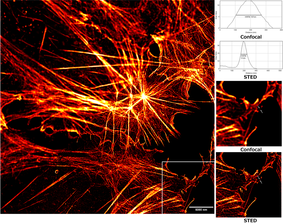 Comparación de resolución entre STED y confocal a 50 nm